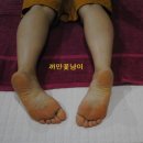 효소체형관리 이미지