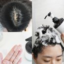 약산성 샴푸 추천 비듬 고민 싹 지우는 해결법