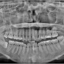 이바른치과기공소 이미지
