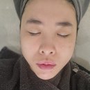 대구 동성로 피부관리 가꾸다 뷰티살롱 뉴바이오필 후기