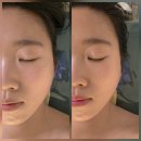 (주)풍림에너지 | 건대피부관리 추천! 소통테라피 더나은피부바디 뇌파테라피