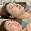 다은에스테틱 | 얼굴살 이중턱 고민러들 서울대입구피부관리샵 리프팅 관리추천, 에스테틱다은 업핏프로그램 후기