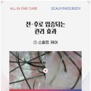 제이미스칼프
