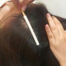 밀스칼프 이미지