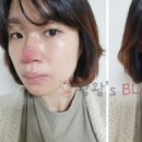 제이제이(JJ)피부