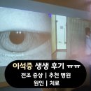 송은철신경과의원 | 후반고리관 이석증 판정 생생 후기.. | 전조 증상 | 추천 병원 | 원인 | 치료 등