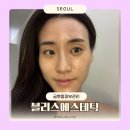 트리거 | 금호동피부관리 블리스에스테틱 콜라겐트리거 탄력 리프팅 관리 솔직후기