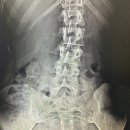 (주)메디투윈 | 대구 연경동 여성전용 PT샵 l 투윈핏 l 내돈내산 골반교정 ㅣ PT 30회 후기