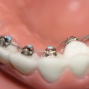 루시아치과의원 이미지