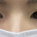 리트머스성형외과 이미지