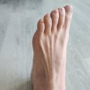 곽재활의학과의원 네이버블로그