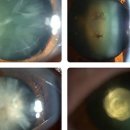 조대안경 이미지