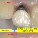 이바른치과기공소 이미지