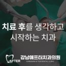 강남애프터치과의원 이미지