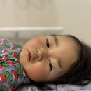 아문성형외과의원 | 하루 사이에 5년 늙는 방법