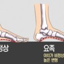 후곡 이미지