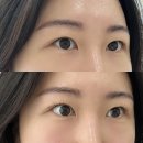 더라인 | 청라속눈썹펌 + 영양 + 팅팅 받은 후기 : 더제이라인