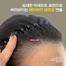 명도헤어라인 네이버블로그