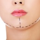 비즈성형외과의원 이미지