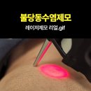 톡쏘는 시원함과 청량감이 있는 레이져제모 시술 이미지