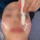 금강스파 | 안양 평촌역 웨딩관리는 스킨타임스파, 좌우 비대칭 얼굴형 교정된 후기