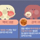 애룰바디 이미지