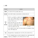 수두 감염예방 수칙 이미지