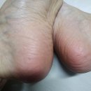 동성기공사 네이버블로그