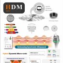 HDM (Hybrid Dynamic Micro sonic) 이미지