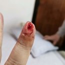 정릉제일정형외과의원 이미지