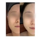 송리단길 작은얼굴 체형교정 | [대구 북구] 아르떼 칠곡점, 대구체형교정 작은얼굴 윤곽관리 후기