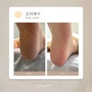 봉덕초교 | 청주 발각질관리 패디플래닝 후기｜로라제이 발뒤꿈치 각질관리