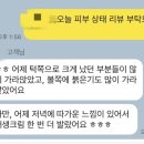 다르아크네 네이버블로그