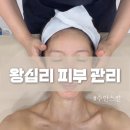 아름다움스킨테라피 | 왕십리피부관리 안면홍조 고민으로 찾은 수안스킨 수화강테라피 후기