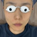 785 | 완전 만족하는 <헬리오스785 피코토닝> 시술 내돈내산 후기 2탄