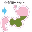 위 이미지
