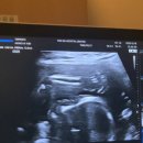 아마존여성의원 이미지