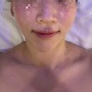 에스와이뷰티크 분당본점 엑스터 관리 후기