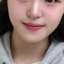 어바웃 알린