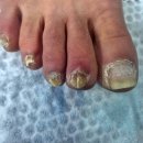 동성프라자 | 본네일 동성제약 풀리메디에서 무좀 발톱 관리한 실제 후기