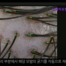 뉴헤어모발성형외과의원 | [강남 강남구 성형외과 추천] 뉴헤어모발성형외과의원 탈모 고민은 여기서 해결