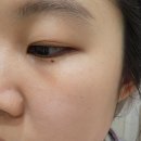 네이처메디 | 피부 속 깊이 촉촉한 보다메디 힐 바이 네이처 세럼 실제 사용 경험 후기!