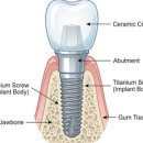 연세온아치과병원 이미지