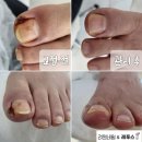 려원네일& 레푸스 네이버블로그