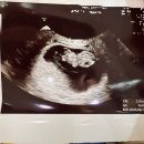 행복한리약국 | 임신 일기 7-8주차, 노원 산후조리원 예약부터 분만 산부인과 메디아이 진료 및 영양제 상담 까지