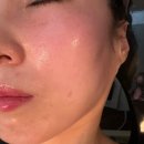 로얄맨션2차 | 울산 중구 에스테틱 은빛에스테틱 웨딩관리 탄력관리