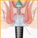 상쾌한 항구병원 이미지