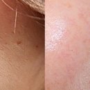 UR(강릉시)-[수리골길]-상-2 | 강릉피부샵 뷰티다룸 강릉 교동점 울트라 윤곽관리로 얼굴이 작아졌어요.