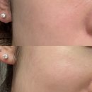 오랩 | 브이모드 300 부스터샷 고순도 글루타치온으로 속 기미까지 관리하는 프리미엄 미백 홈케어