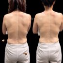 현덕약국 | 허리 통증 잡고 옆구리 살까지 단번에 빼봐요 | 청북 포승 통증 완화 다이어트 알로바디랩